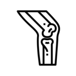 Kĺby